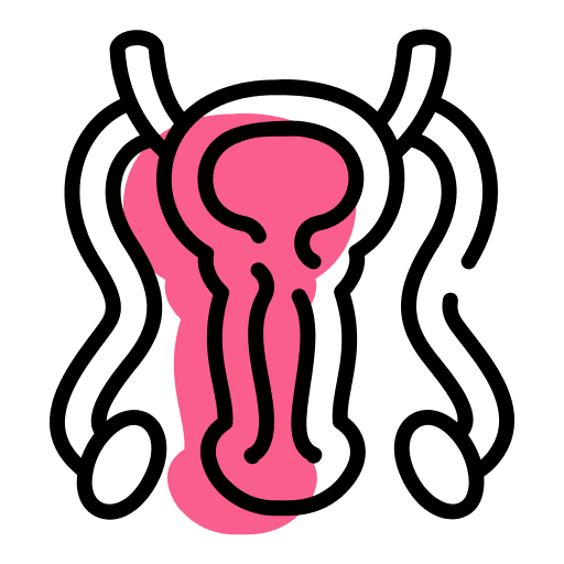 Micro TESE microsurgical testicular sperm extraction procedure for azoospermia treatment by Dr. Arun Muthuvel in Chennai